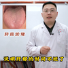 这种舌头，你以为是脾虚？肾虚？那你想的也太简单了
