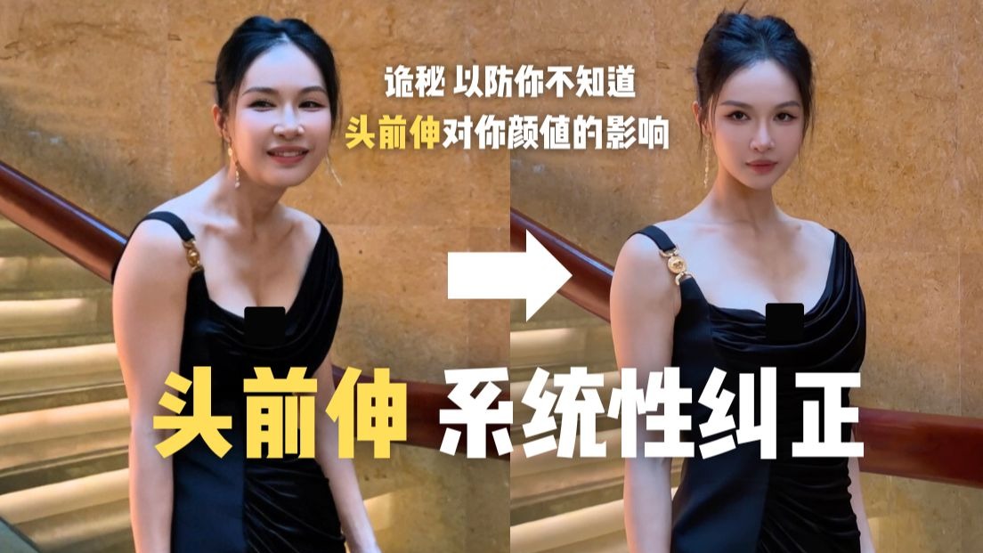 诡秘 你的颜值被头前伸封印了