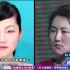 中国女孩去韩国整容失败，全脸动刀，摘下口罩吓坏嘉宾