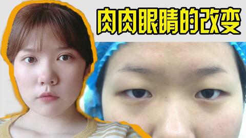 fd2697a2686877f59b6d18ccbcba86211622604f.jpg@480w_270h_1c