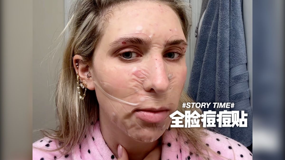 挑战全脸痘痘贴