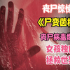 丧尸病毒爆发，女孩是唯一免疫体该如何拯救世界