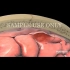 3D医学动画：《了解脑溢血》