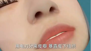 什么办法能让鼻子缩小 fdff2d21bcd814eeb764e95470559c36c1a0c5ca.jpg@310w_174h_1c_100q.jpg