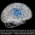 【The Economist 经济学人】【中英双语】Why is Alzheimer's still a medical