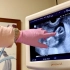 三胎的第一次产检, 宝宝性别这是可以说的吗？