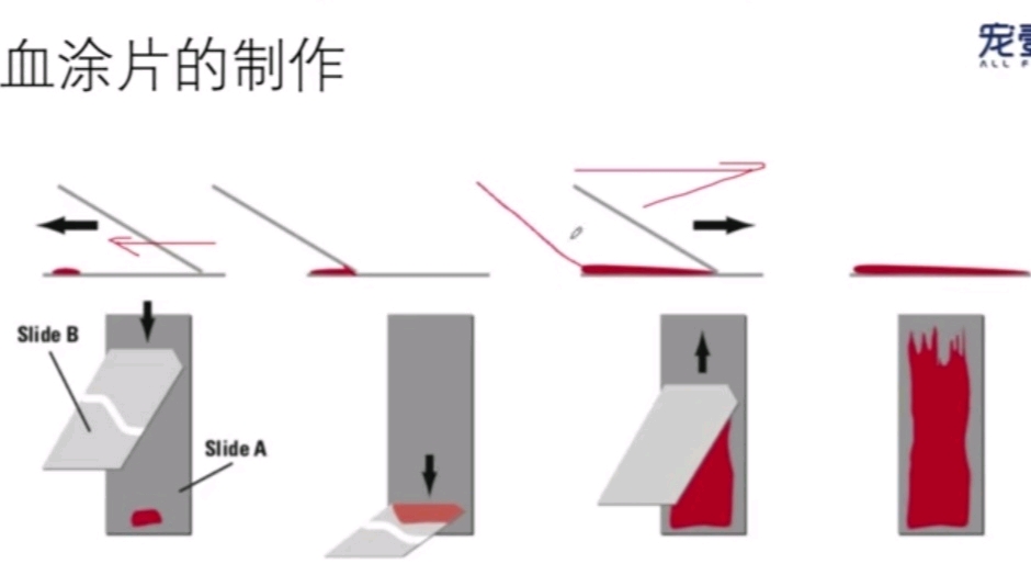 血涂片制作方法