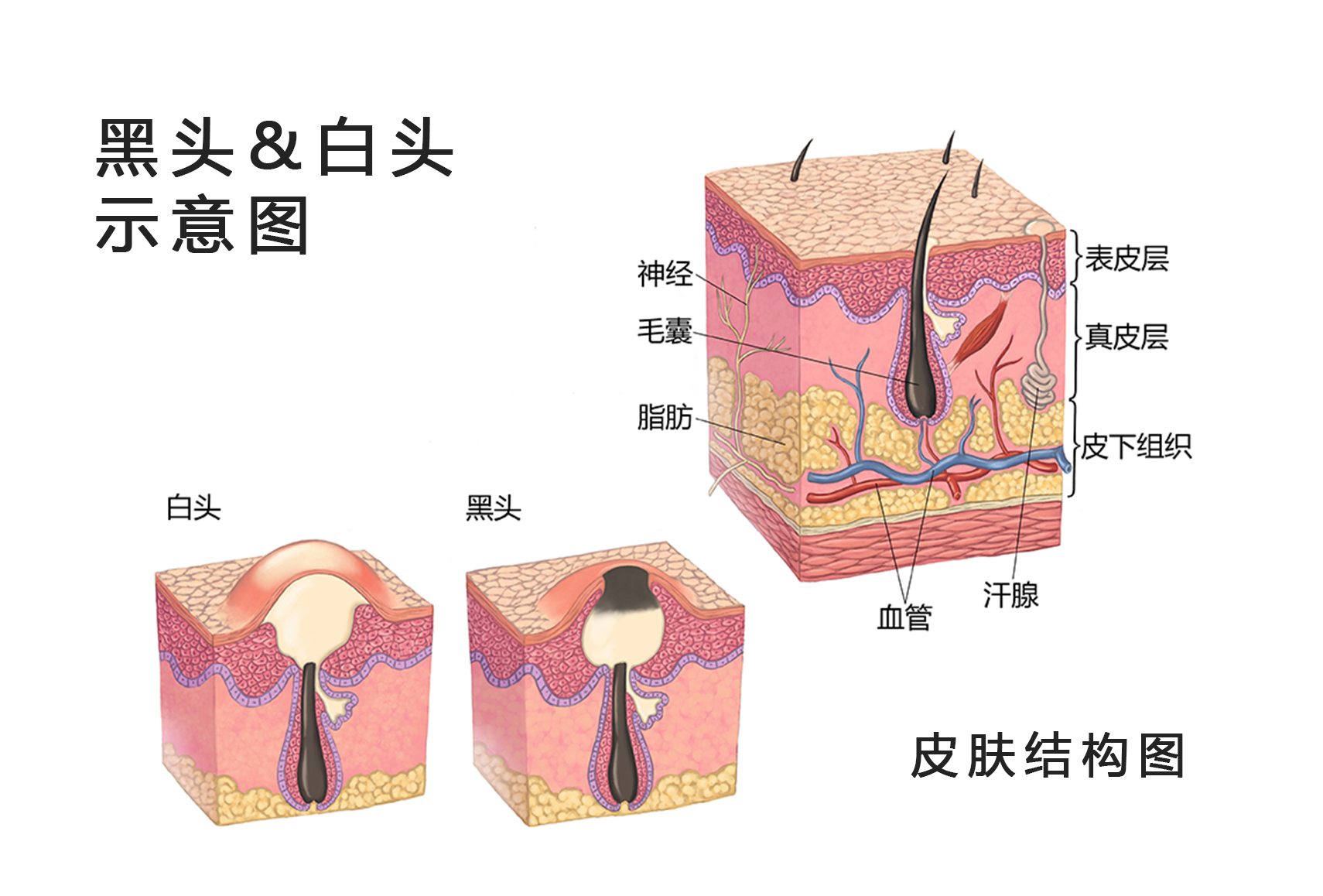 怎么可以去掉黑头 058fbe14f3254319d8da003c3d821dec1ac40aaf.jpg