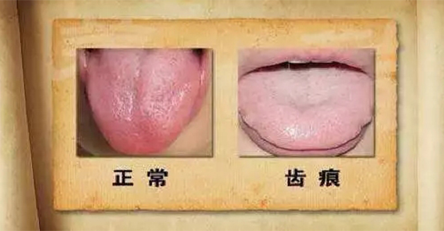 珍贵舌诊:脾胃虚寒,胃阴不足,气滞血瘀的舌苔,看完记得存!