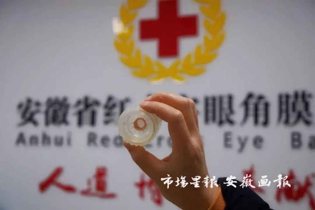 由于呼伦贝尔市一直未找到合适的眼角膜受捐者，两片珍贵的眼角膜在眼库