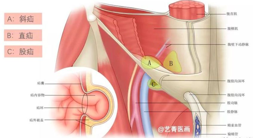 普外1