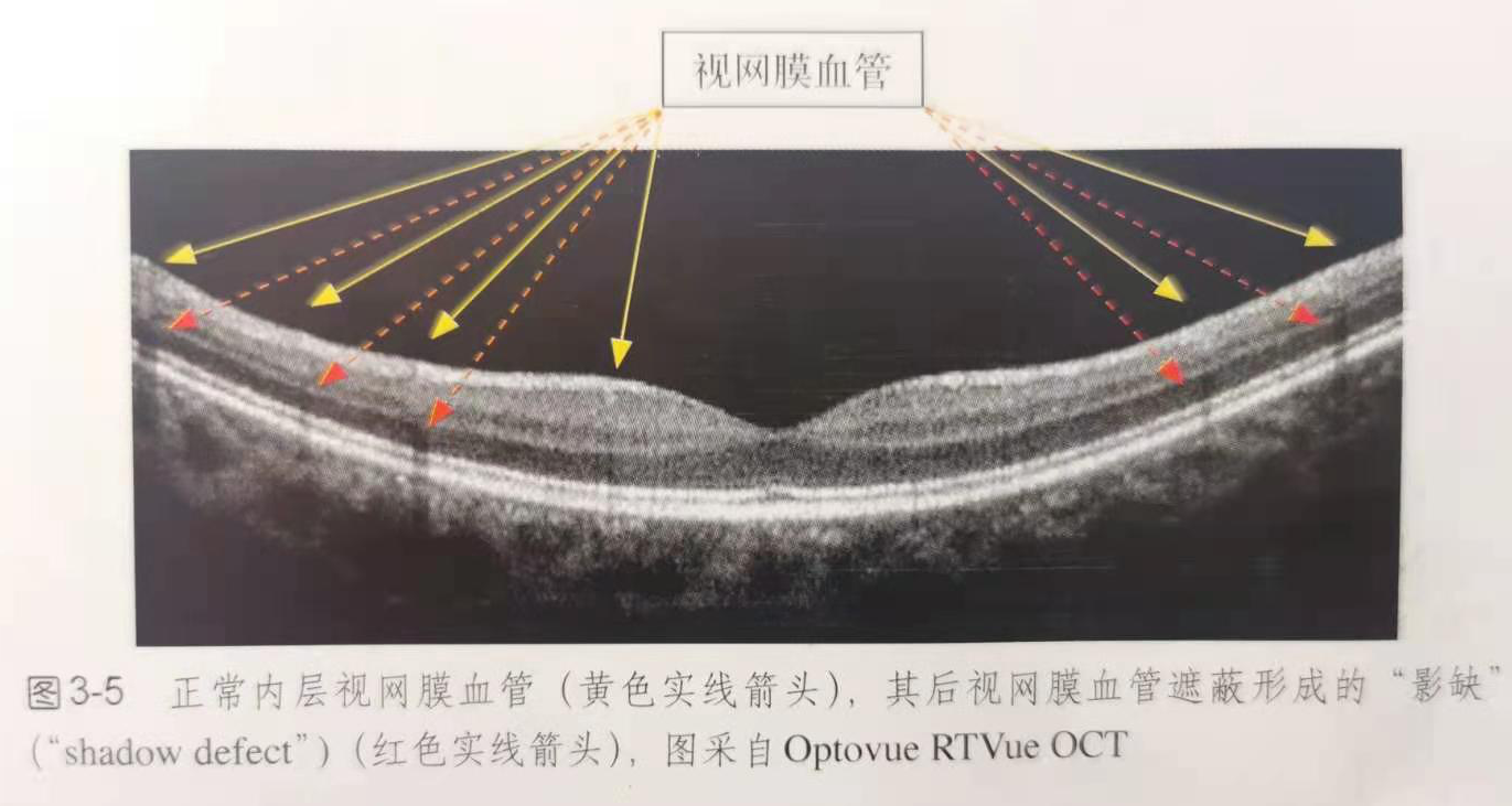 黄斑凹:umbo 中央凹无血管区faz:foveal avascular zone 【视网膜的a