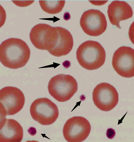 光镜血涂片下的血小板,图源自课件