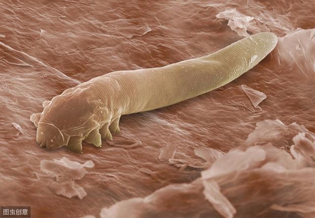 什么是蠕形螨显微镜下螨虫是怎么样的眼痒眼干或许与它有关