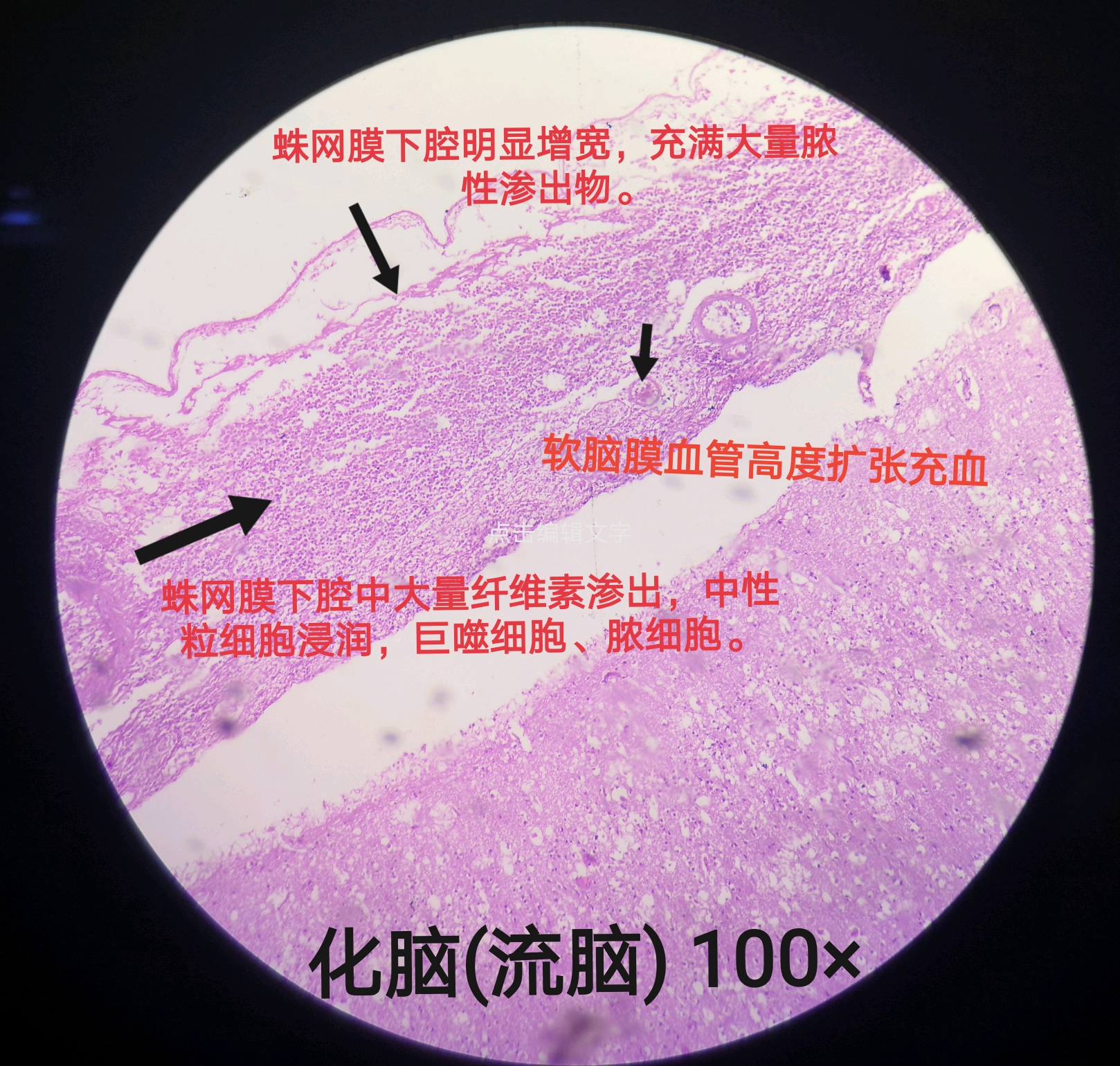 病理学实验切片