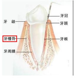 二,牙槽骨的骨密度和骨量是能否种植的关键 除了禁忌症,老年人能否做