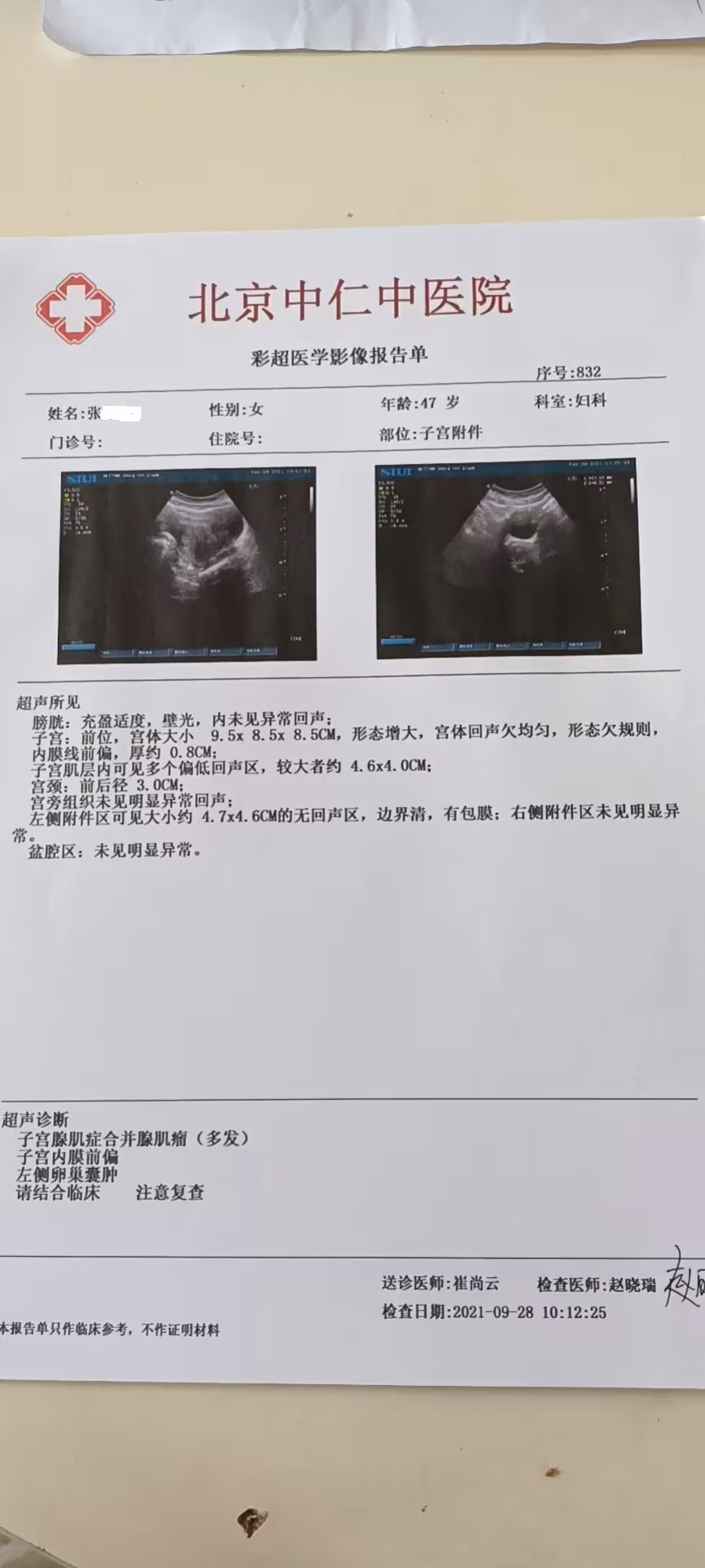 治疗子宫腺肌症不按常规出牌反而效果好?谈中药奇方汤剂治疗原理