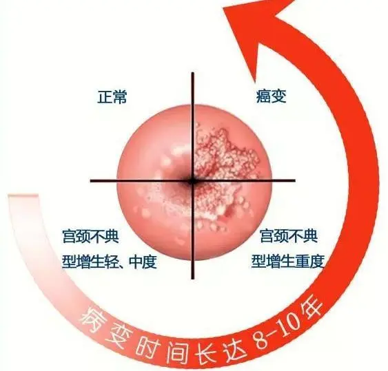 38岁孕妇担心hpv感染胎儿，决定人流后悔一生！
