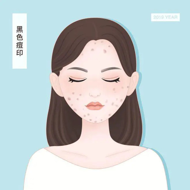 如何快速消除痘印