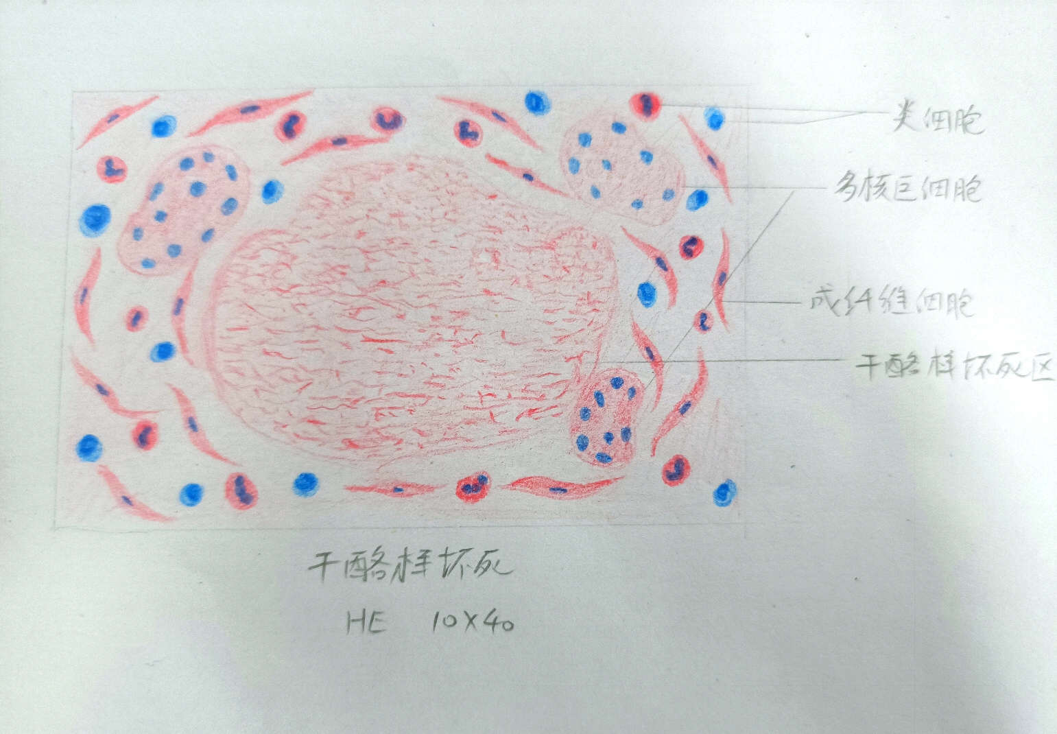 【病理学实验红蓝铅笔绘图】细胞的适应,损伤与修复