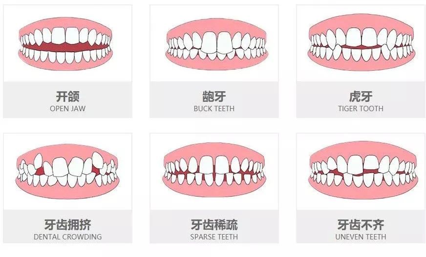 牙齿矫正有什么弊端?荷马口腔为你讲解