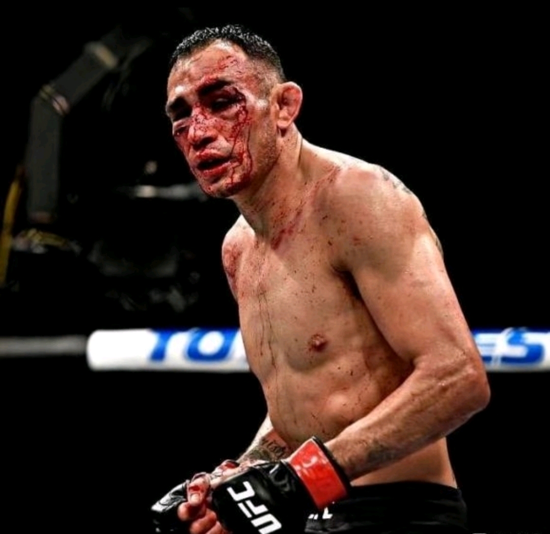 ufc冠军录之"夜魔"托尼·弗格森本纪(附夜魔v"巴西林志炫"奥利维拉