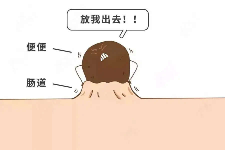 大便卡在肛门出不来怎么办?重庆肛肠医院?