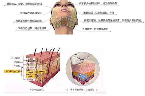 热玛吉的作用原理有哪些!