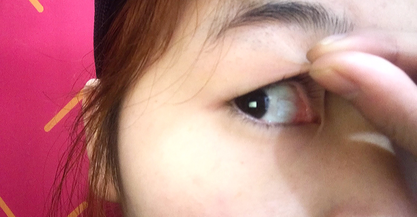 内双肿步骤也有看得见的双眼皮泡制方法眼泡绿茶图片