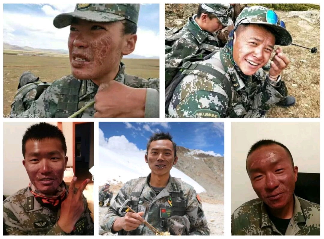 还有龟裂,脱皮"沟壑交错"的生疼 网友说这是中国军人最真实的照片 更