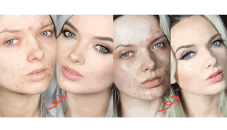 女人变老四部曲: 黄,干,累,冷!如何缓解?