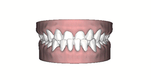 2020年是最适合矫正的一年,你想知道矫正之后牙齿会变成怎样吗?