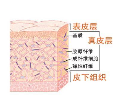 激光洗纹身到底能不能洗掉