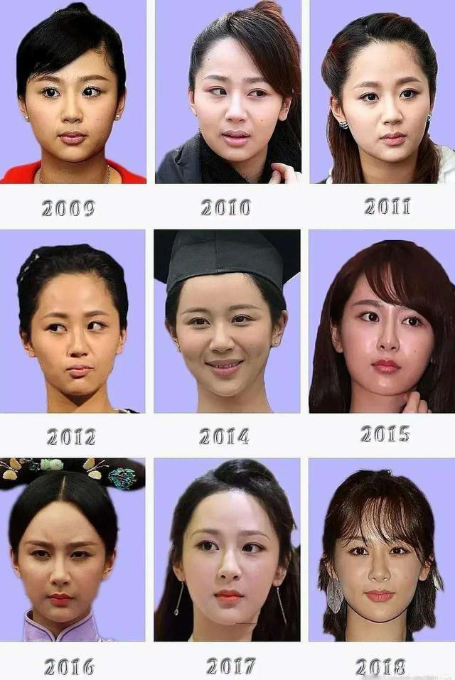 杨紫10年正脸照对比,看看她究竟是否整容