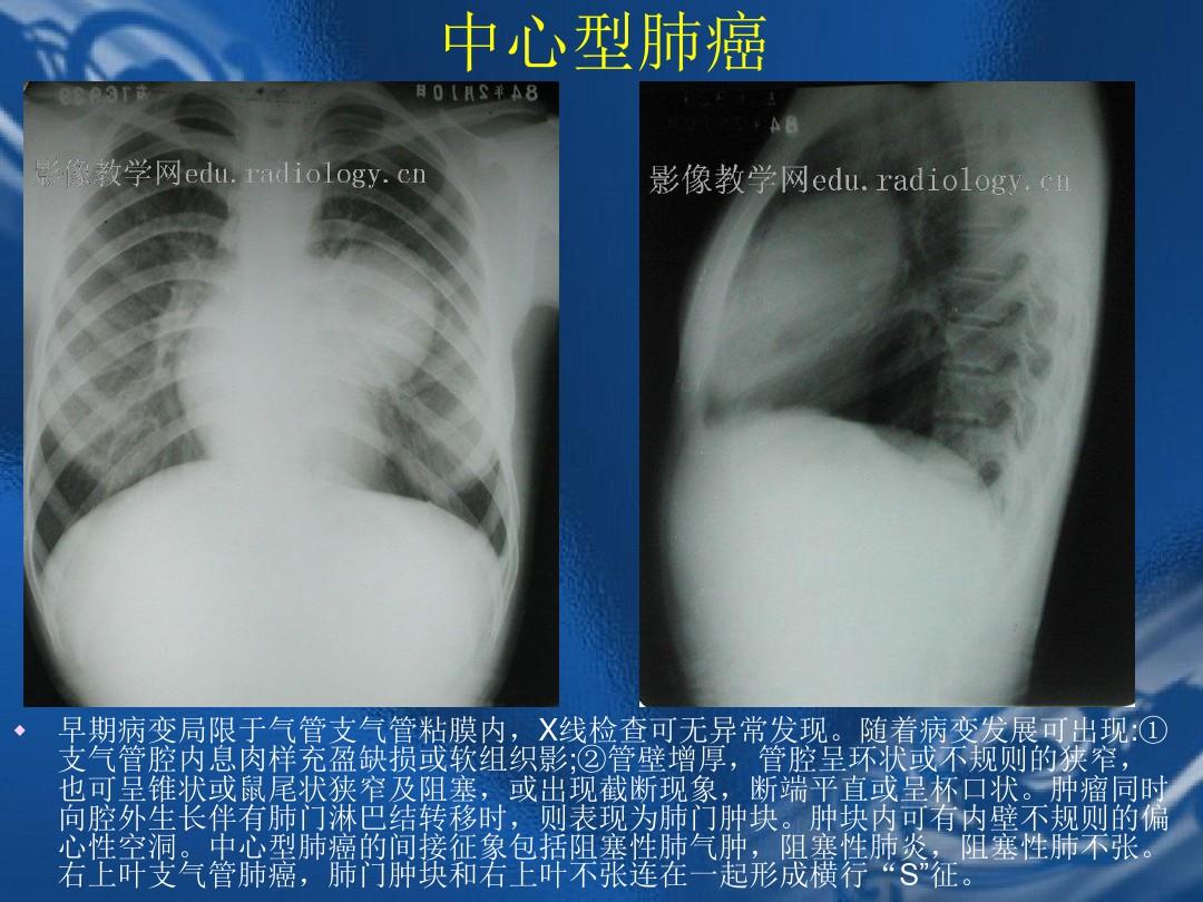 其原理是利用了x线的穿透作用