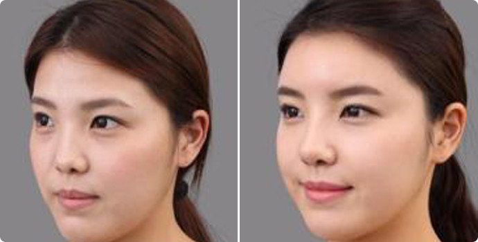 扁额头方脸适合什么鼻子,扁额头方脸适合什么鼻子好看