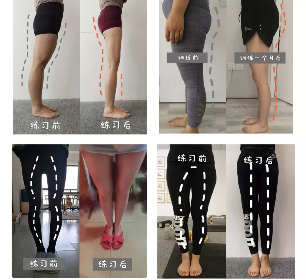 肌肉腿,脂肪腿,o型腿…不到一个月全部变成了细长直!