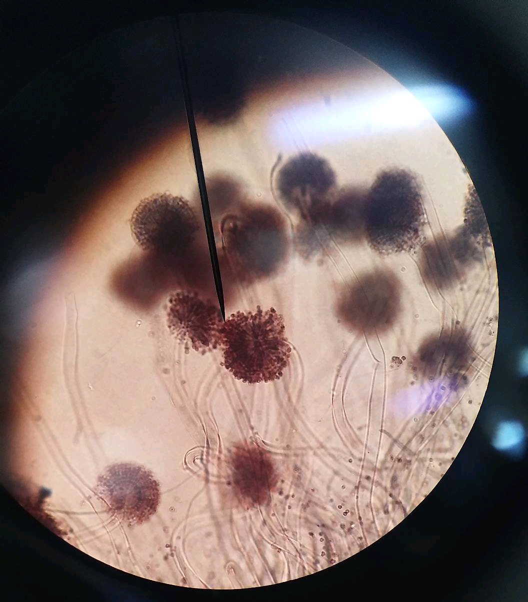青霉,曲霉,毛霉,根霉,放线菌 形态 图片
