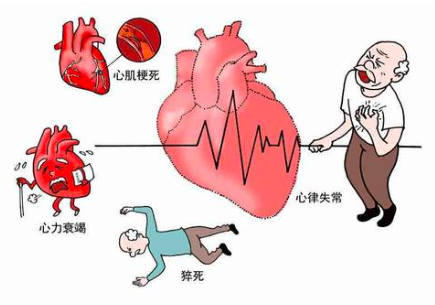 得了冠心病严重吗?中药能替代西药吗?血塞通的功能与主治是什么?