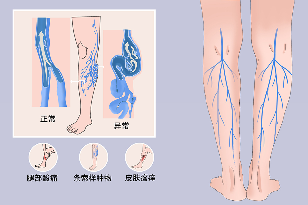 下肢防守技术难点,下肢防守技术难点是什么