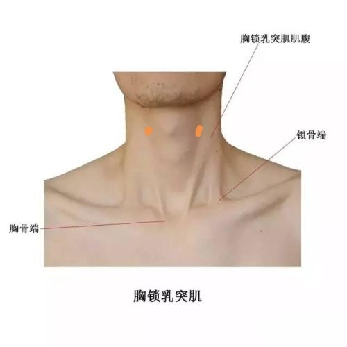橙点的位置大致为胸锁乳突肌内缘深部能感受到颈动脉搏动的地方.