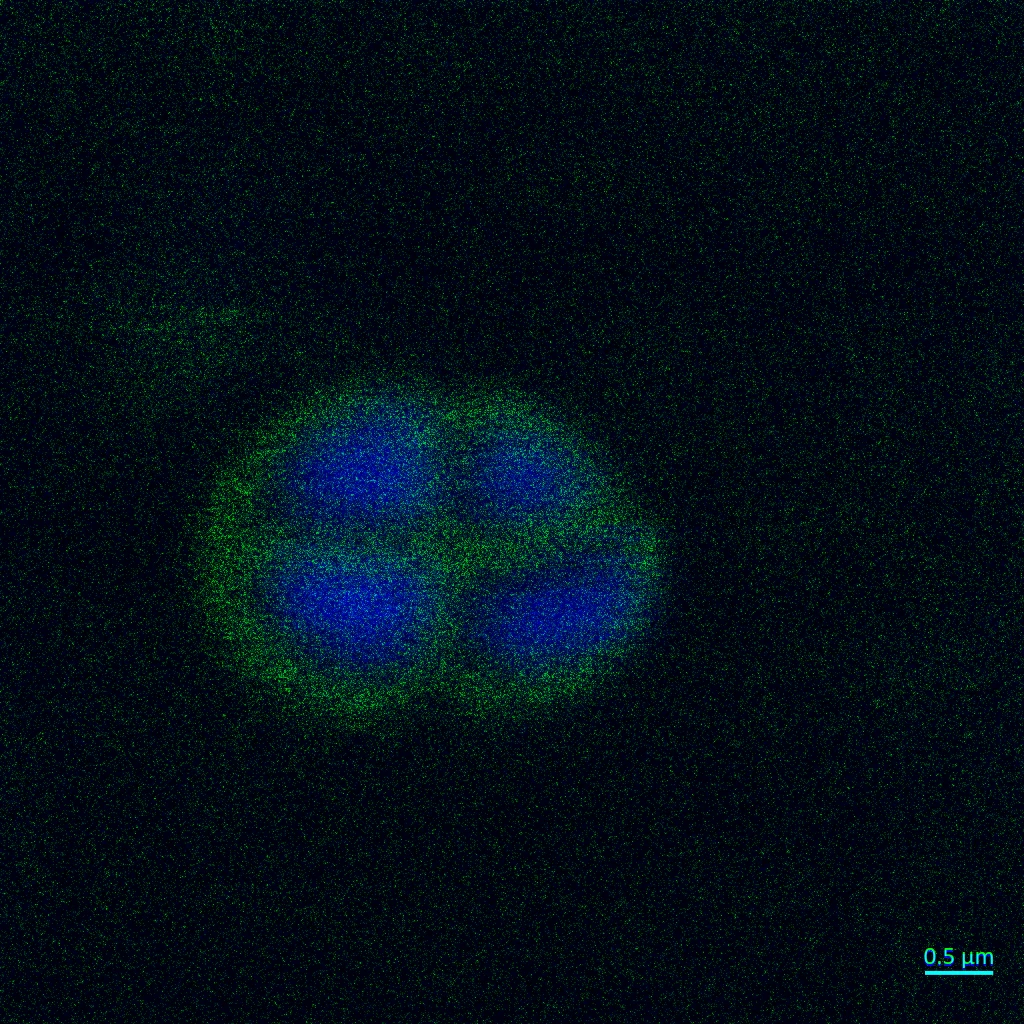 Deinococcus Radiodurans R