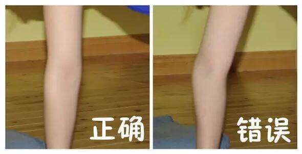 膝关节超伸