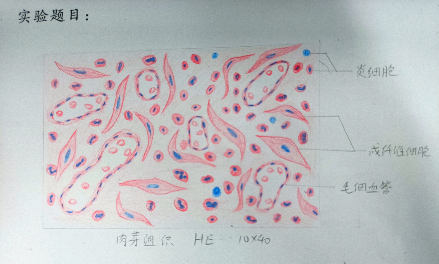 【病理学实验红蓝铅笔绘图】细胞的适应,损伤与修复