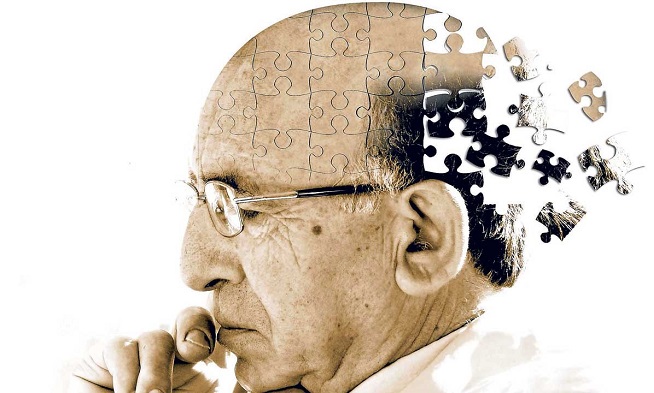 阿尔茨海默症,一种神经退行性疾病,多发于老年,出现记忆障碍,失语