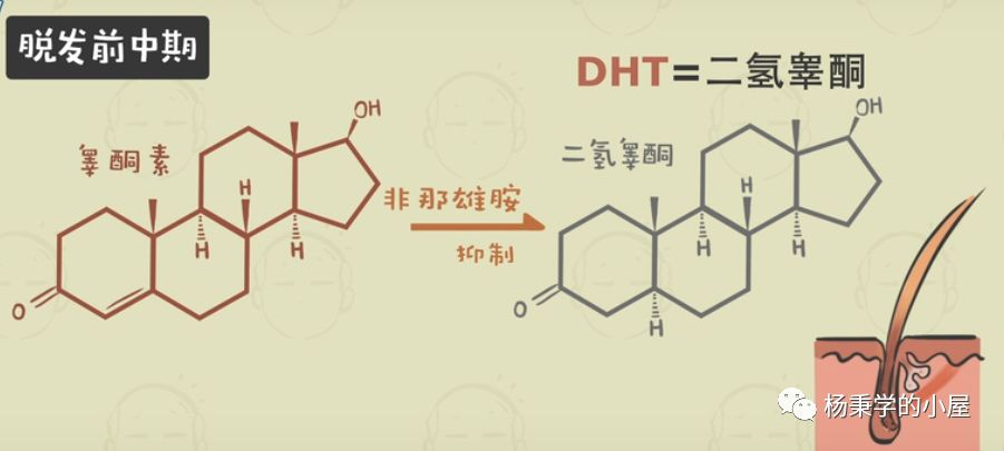 人为什么秃顶