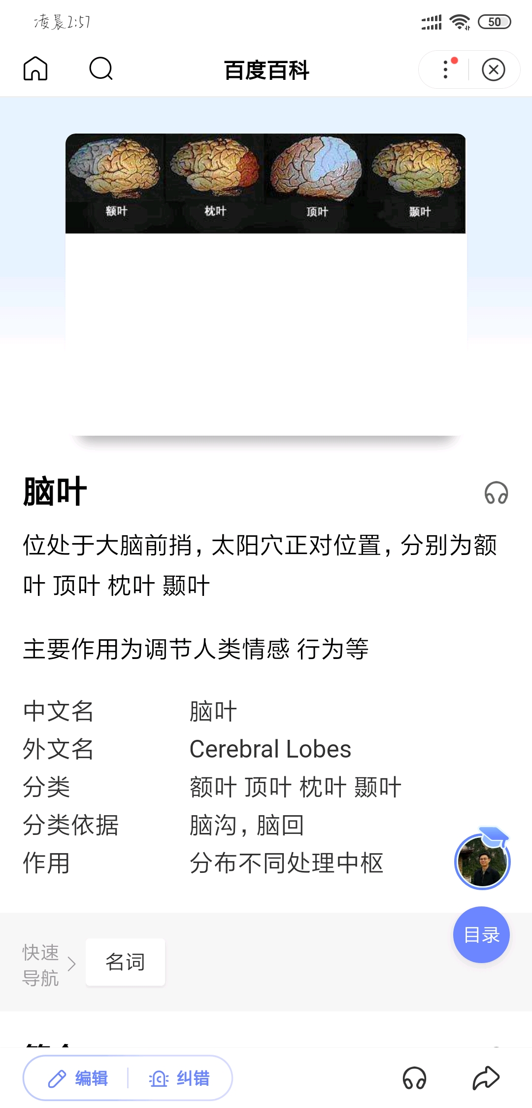 单机游戏 为什么会叫《脑叶公司》 后来了解一些剧情后,以为和盒子精