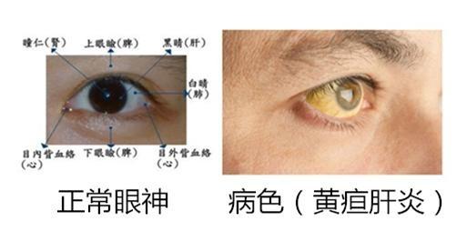 望:中医四诊法之首