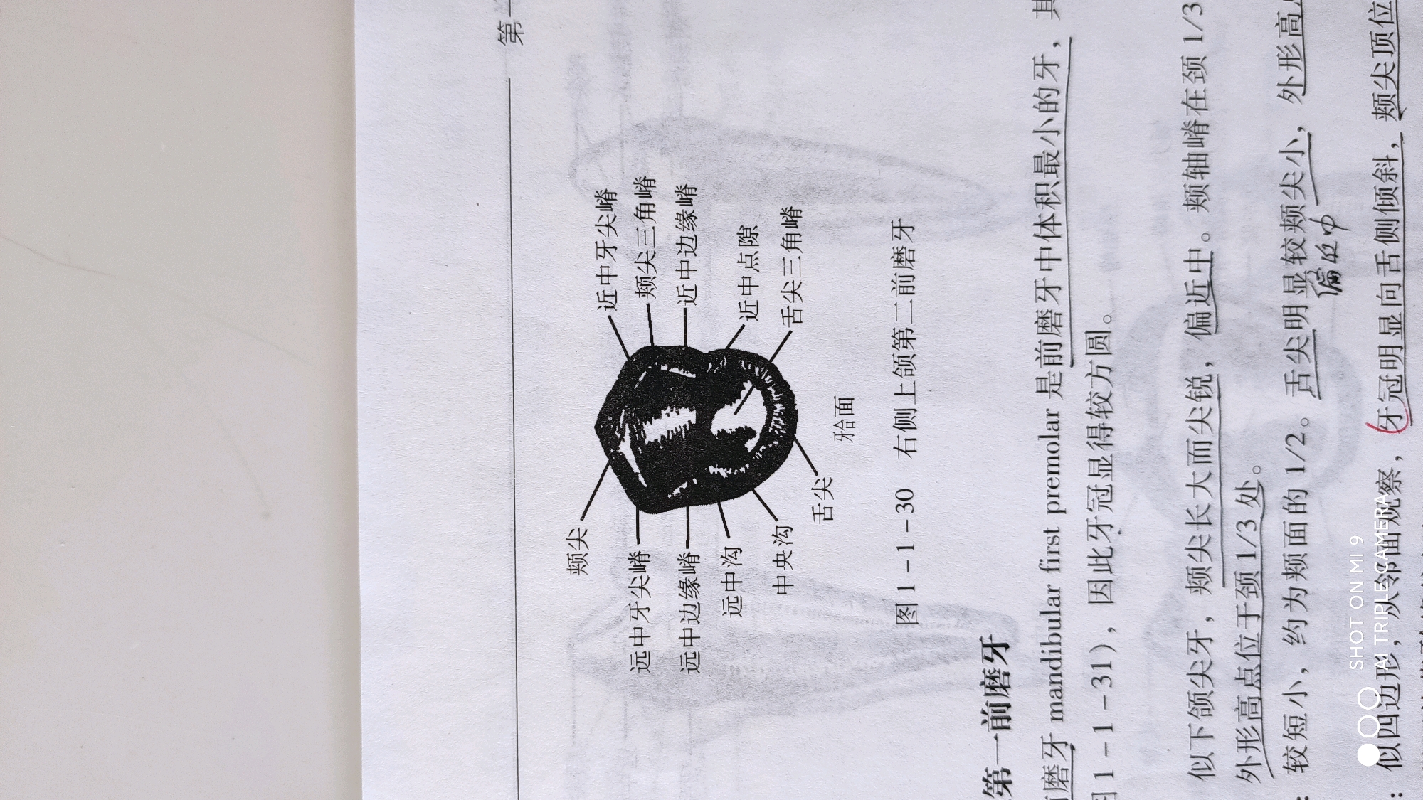 右侧上颌第二前磨牙