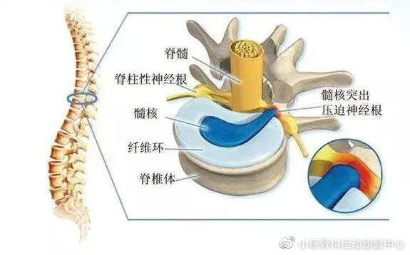 椎体之间,是一个具有流体力学特性的结构,由髓核,纤维环和软骨终板三